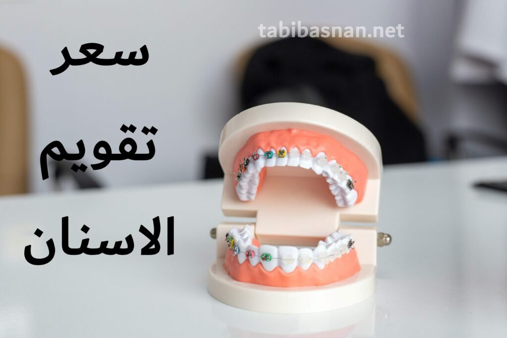 سعر تقويم الاسنان وتكلفة تقويم الاسنان في مصر والدول العربية